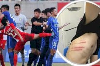 العنف يضرب الملاعب الصينية 