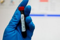 ترقب لقرار اللجنة الأوليمبية بشأن العقوبات على روسيا