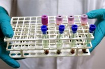 اكتشاف 45 حالة منشطات جديدة في اولمبيادي بكين ولندن