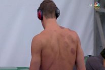 حجامة السباح الأميركي فيلبس تثير الفضول في أولمبياد ريو