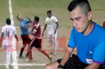 اعتداء عنيف من لاعب مطرود على حكم في مباراة بـ