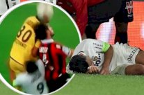 المهاجم الكولومبي فالكاو لا يزال في المستشفى بعد إصابته في الرأس