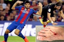 سواريز يسخر من فيليبي لويس : كرة القدم للرجال !