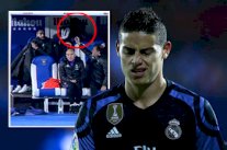 خاميس رودريغيز يثير الجدل بضرب يده حائط مقاعد البدلاء !