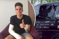 بارترا المصاب في اعتداء دورتموند يتماثل للشفاء بعد العمية الجراحية