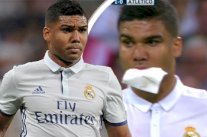 إصابة عنيفة لكاسيميرو في دربي دوري أبطال أوروبا