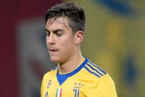 يوفنتوس يفتقد ديبالا شهرا بسبب الاصابة