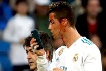 رونالدو يستعين بكاميرا الهاتف للتعرف على مدى إصابة