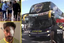 الاعتداء على حافلة بوكا يرجئ نهائي ليبرتادوريس حتى إشعار آخر