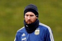 شكوك حول مشاركة ميسي في ودية إيطاليا بسبب مشكلة عضلية