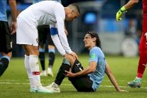 تضاؤل فرص مشاركة كافاني ضد فرنسا