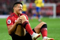 سولسكاير يؤكد غياب التشيلي سانشيز نحو ستة أسابيع