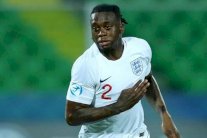 الإصابة تبعد وان-بيساكا عن تشكيلة إنكلترا في تصفيات كأس أوروبا