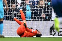 إصابة الحارس الفرنسي لوريس بخلع في كوعه