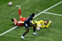 موسيالا يغيب لفترة طويلة بسبب كسر في الشظية وخلع في الكاحل (بايرن) 