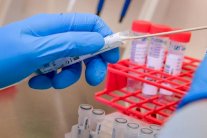 هل اقتربنا من إنتاج لقاح مضاد لكورونا؟