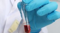 تحليل دم بسيط يكشف 50 نوعًا من السرطان