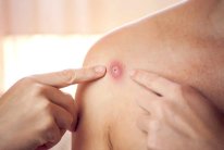 المغرب يرصد 3 حالات يشتبه في اصابتها بـ