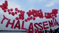 الثلاسيميا: أكثر من 3500 حالة في إقليم كردستان العراق
