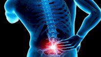 دراسة جديدة تكشف عن علاج ثوري ينهي آلام الظهر تماما