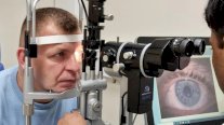 تقنية جديدة تقلب الموازين في جراحة العيون بالمملكة المتحدة