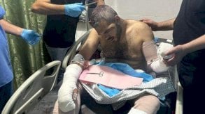 فلسطيني معارض لحماس يضرب على يد ملثمين في غزة