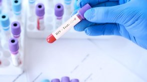 لماذا تزداد أعداد المتعايشين مع فيروس نقص المناعة في الشرق الأوسط وشمال أفريقيا وتنخفض في باقي العالم؟