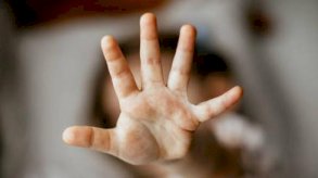 يد إنسان تطلب الحماية من الآخرين - Getty Images