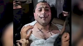 قصوا شعره وكتبوا على وجهه.. هكذا اعتُدي على فنان سوري في وضح النهار