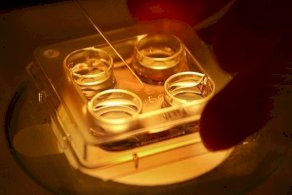 تجميد البويضات: فرصة لممارسة الأمومة في عمر متقدم