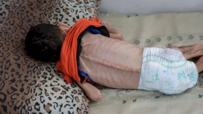 أطفال غزة يدفعون الثمن: وفاة طفل بسبب المجاعة وسط القطاع