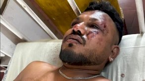  الناحي الوحيد من كارثة مطار أحمد آباد يتحدث..